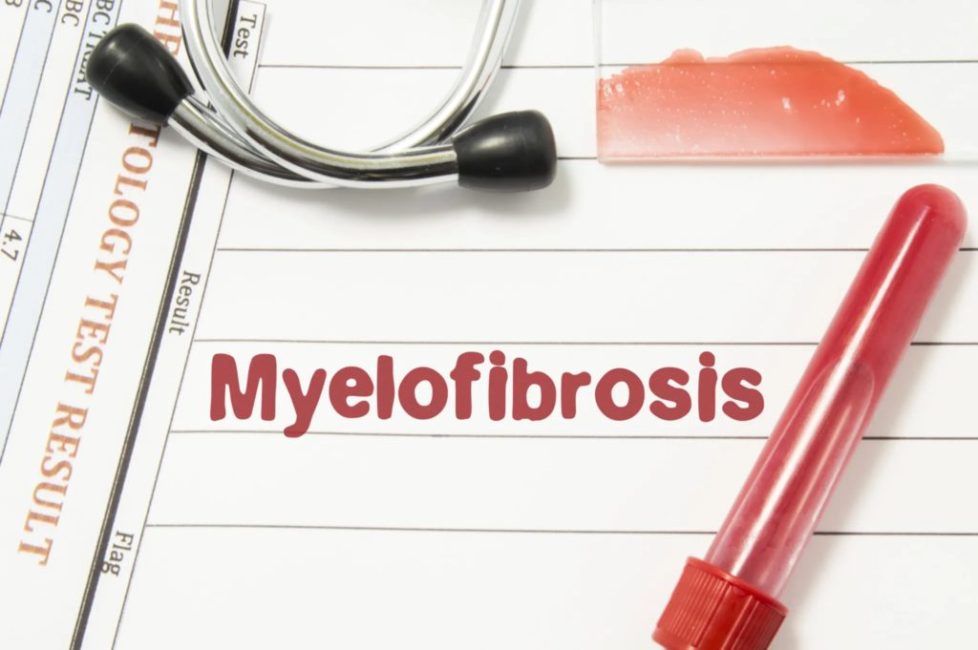 Feature-Image-for-What-is-Primary-Myelofibrosis-page-scaled